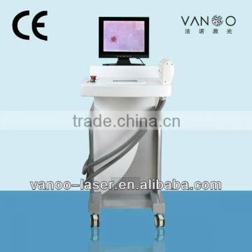 intense pulsed light machine