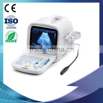 2016 High Quality Big promotion Digital Portable Ultrasound Scanner/Machine inside working station-RUS-9000A