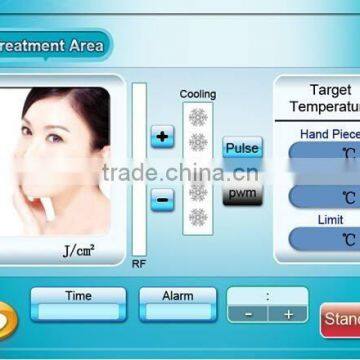 Ipl Rf Skin Tighten Mongolian Spots Removal Elight Nd Yag Laser Machine Hori Naevus Removal