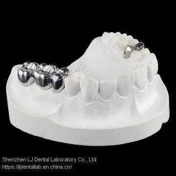 Full Metal Crown, FMC, FGC, Full Metal Post Core, Dental Crown, Cast Metal Crown, Dental Prosthesis, Laboratorio Dental, Dental Laboratory, Dentallabor, LJ Dental Lab China photo-5