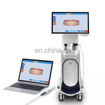 MY-D072 CE Approved Dentist Equipment Intra Oral Camera Portable Dental 3d Intraoral Scanner Price photo-3