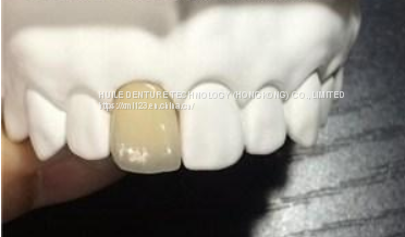 Myy International Dental Lab All on 4/6 Dental Manufacturer