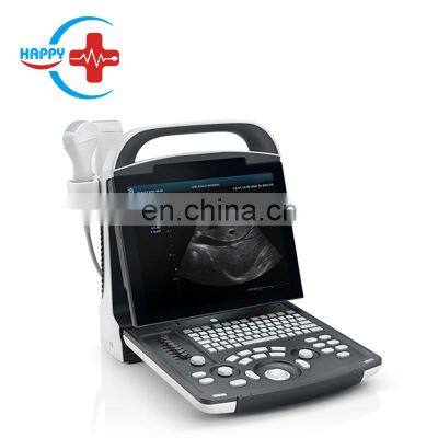 Original Mindray DP-20  ultrasound portable digital ultrasound system with super PW Doppler image