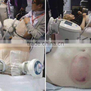 4 Cryo Handles Cryo Lipolyse Equipment/Cryo Lipo Machine/ Cryo Laser Slimming Machine for Salon Use photo-6