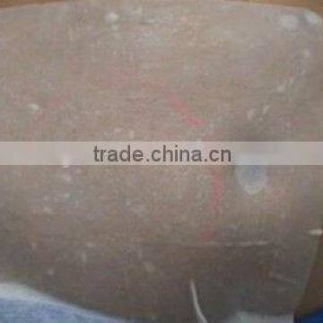 Cryotherapy Freezing Machines-Antifreeze Membrane Provide photo-5