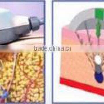 New Technology Wrinkle Removal Ultrashape Weight Loss Salon Machine
