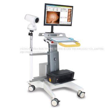 YKD-1001 Full HD Infrared Mammary Gland Examination System