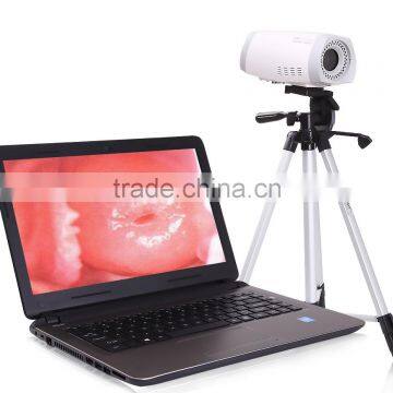 Portable Digital Electronic Colposcope in Cheap Price photo-3