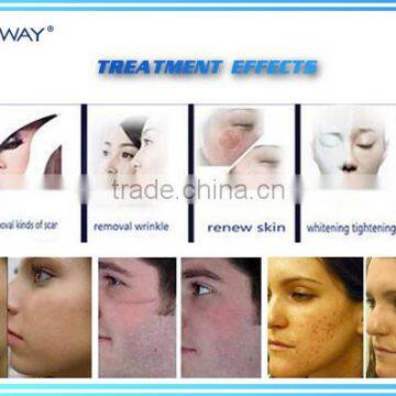 USA Laser Vaginal Tighten Medical Use RF Fractional Co2 Laser photo-6