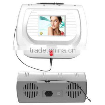 Nubway high frequency 30MHz Removal vein / thread vein removal /vascular removal machine