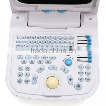 Beautiful Compact Diagnostic Ultrasound Probe / Mini Ultrasound Machine / Portable Ultrasound Scanner photo-5