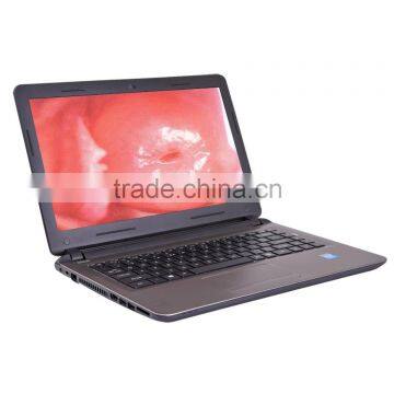 Portable Digital Electronic Colposcope in Cheap Price photo-2