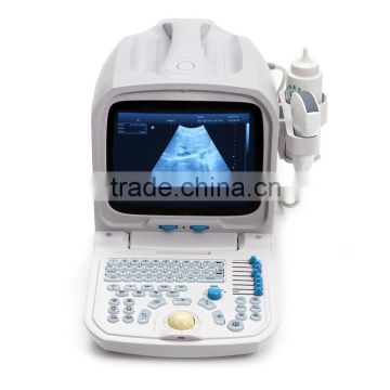 Full Digital Portable Ultrasound Scanner RUS-9000A PC platform 3D workstation