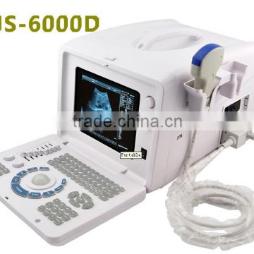 Cheapest Digital Portable Ultrasound Scanner RUS-6000D