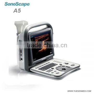 medical 2d portable color Sonoscape ultrasound a5