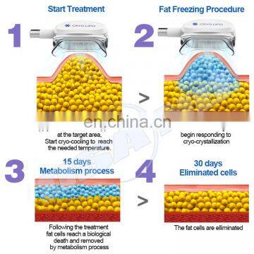 Portable Crio Lipolisis Beauty Machine Fat Freeze Slimming 360 Cyrolipolysis Machine photo-5