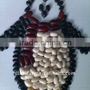 Japanese white kidney bean 2011 crop, Heilongjiang origin, Hps)