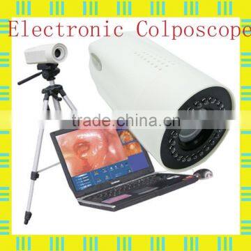 Digital Laptop Colposcope for Gynaecological/vaginal & uterine diagnosis/surgery