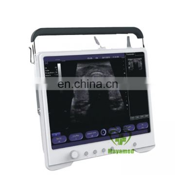 MY-A012 portable vagina images laptop ultrasound scanner price in China