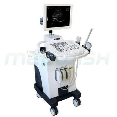 DW-370 Full-Digital Trolley B/W Ultrasound System