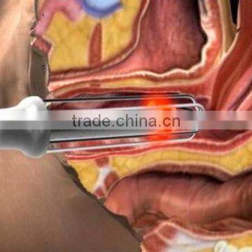 Tumour Removal Co2 Laser Power Supply Professional Fractional Co2 Laser Spot Vagina Tightening Scar Pigment Removal Machine(manufacturer) / Fractional Laser Co2 Vaginal Tightening Skin Tightening
