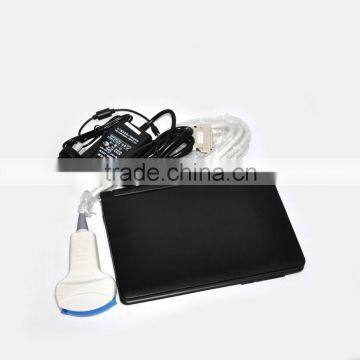 CE Approved Laptop Veterinary Ultrasound Scanner With 3.5Mhz Multi-frequency Convex Probe RUS-9000V photo-2