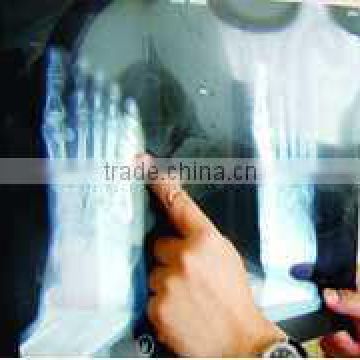 x-ray film with low price x-ray film digital film medical x-ray film