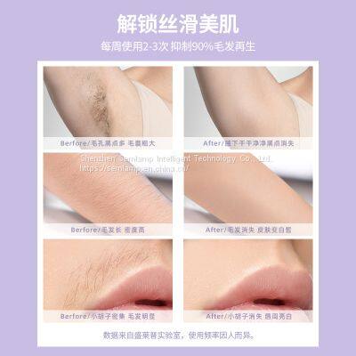 Semlamp Type-C IPL Hair Removal Machine At Home OEM/ODM photo-4