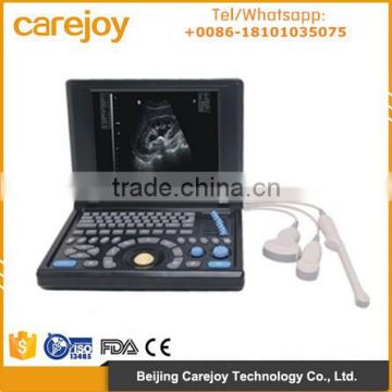 CE&ISO 10.4 inch LCD Laptop Ultrasonic machine PC system 3D Ultrasound Scanner with 3.5Mhz Convex probe 7.5MHz linear probe