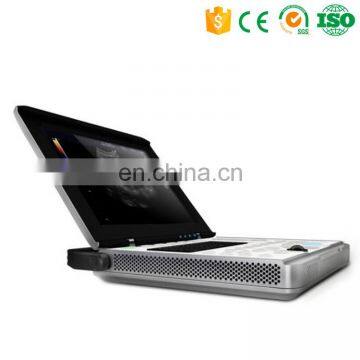 MY-A039A Color Doppler Ultrasound Price Portable Ultrasound Machine photo-2