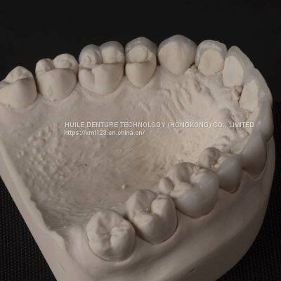 Digital-Crowns-Bridges Dental Laboratory in China photo-4