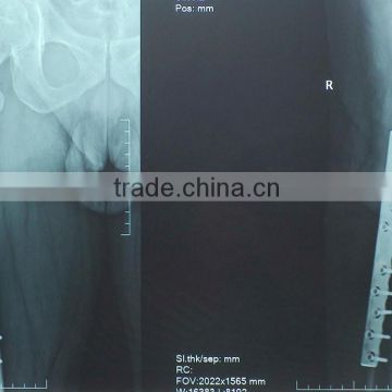 14*17 inch size medical x ray film for fuji imager film diht/di-ht