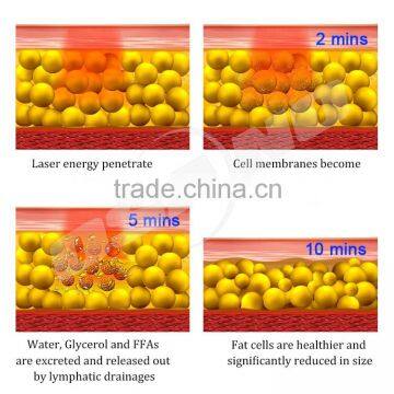 650nm & 980nm Lipo Laser Slimming Machine Lipo Laser Cellulite Reduction photo-3