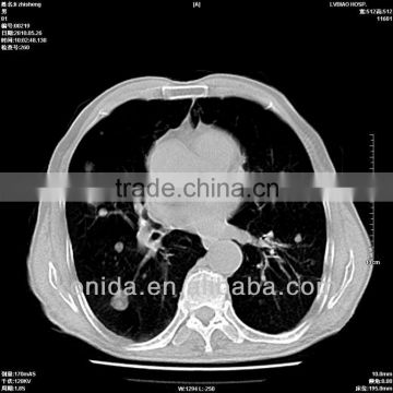 xray developer,x-ray-film viewing boxes,x-ray printer