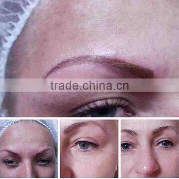 532nm Sanhe Beauty Super Tattoo Removal Machine Q Vascular Tumours Treatment Switch ND YAG Laser/ Face Lifting Machines photo-4