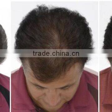 Good Effective Hair Loss Treatment Laser Cap Electric Scalp Stimulator/Ozone Treatment Hair Machine photo-6