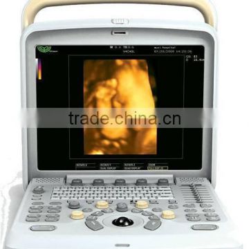 Most Affordable 3D Doppler Ultrasoun