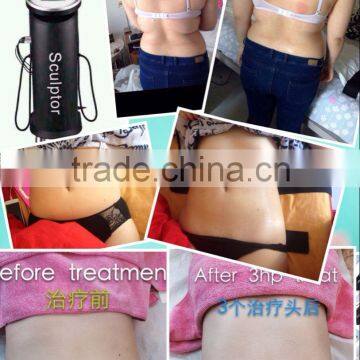 Supersonic Operation System and Weight Loss Feature Weight Loss Electronic Machine/ultrasound RF Lipo Laser photo-3