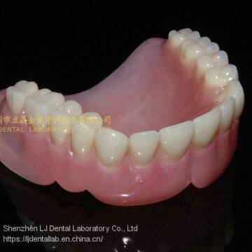 Dental partial acrylic denture, complete denture, full dental dentures, laboratoire dentaire, Dentallabor, laboratorio dental, dental laboratory, Shenzhen LJ dental lab China