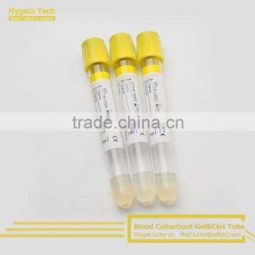 gel and clot activator tube