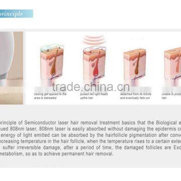 1-10HZ Newest 808nm Diode Laser Face Hair Removal Machine/810nm Portable Laser photo-3