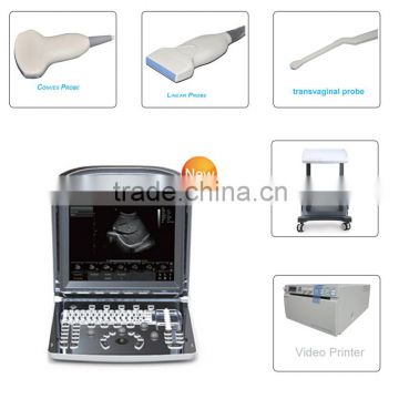 CE approved Portable Chison USB Ultrasound Scanner with 3.5Mhz multi-frequency convex probe ECO1