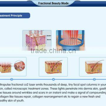 Most Advanced High Quality Beauty Equipment 10600 nm Laser Co2 Surgical Laser With USA Tube photo-4