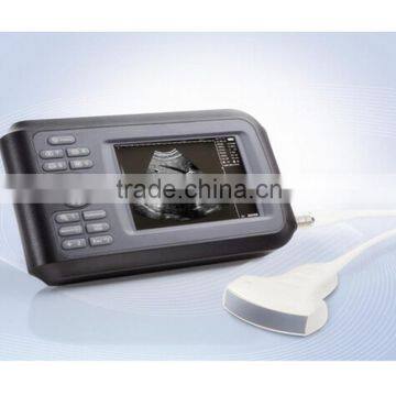 2016 New Handheld Ultrasound Scanner Palm Ultrasound Machine photo-6