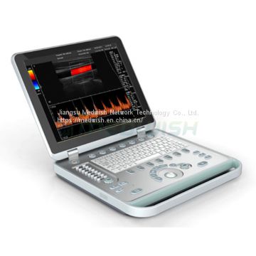 AG-BU005 Laptop Handheld Medical Color Doppler System Mobile Ultrasound Scanner