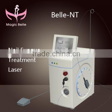 Smart system Fiber 1064nm Nd Yag Laser Nail Fungus Treatment laser for clinic use