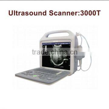 wholesale Portable Digital high quality Ultrasound Scanner