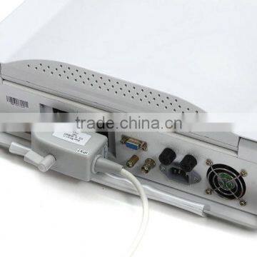 15-inch Laptop Ultrasound Scanner With Multi-frequency Probes photo-3