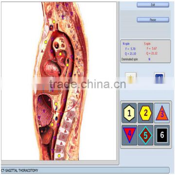 2017 Composition analyze equipment 9D NLS Sub-health detector best 9d nls diagnostic scanner