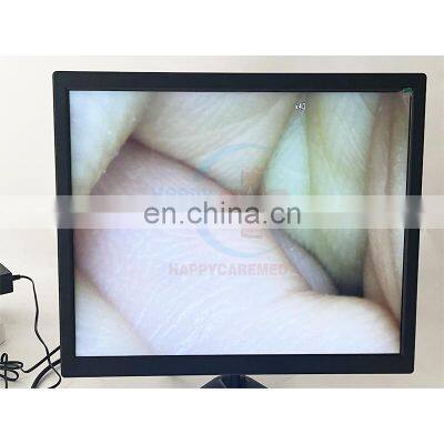 HC-R058F Large Canine Vet Visual Insemination Device desktop tci machines / Veterinary Artificial Visual Insemination equipment